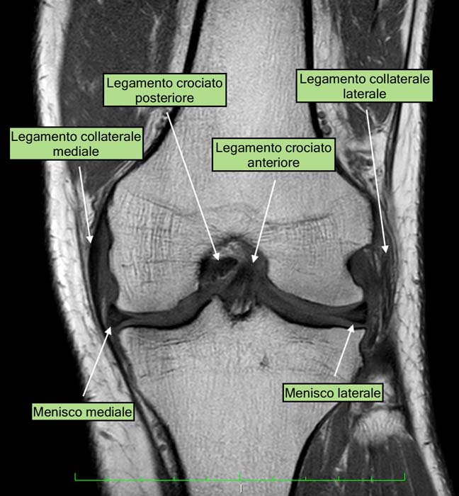 Anatomia del ginocchio (immagine RM)