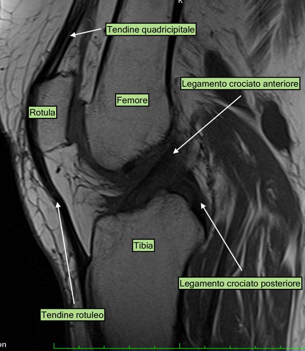 Anatomia del pivot centrale del ginocchio (immagine RM)
