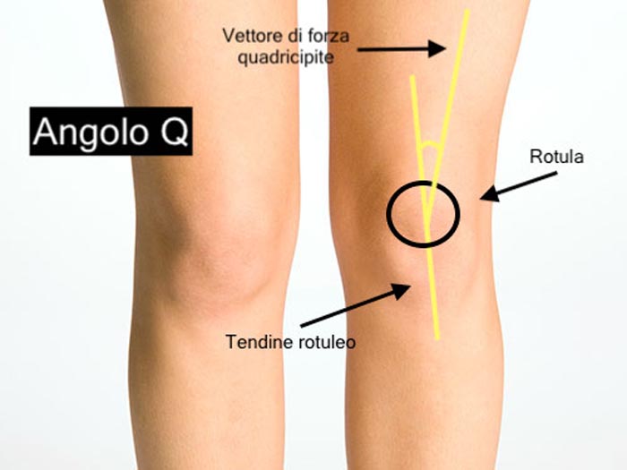 Angolo Q: è l'angolo disegnato tra il vettore di forza del muscolo quadricipite femorale e l'asse della rotula